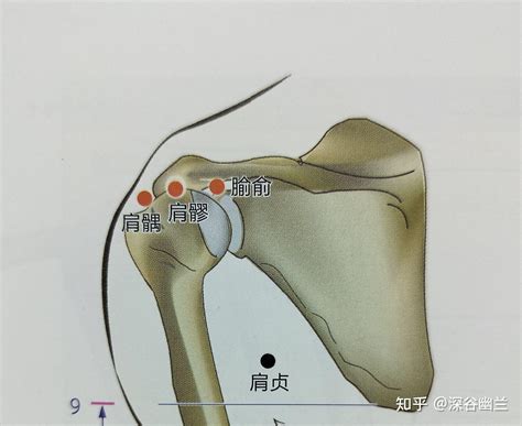 肩ㄩˊ穴|肩髎:命名,穴位解剖,穴位找法,標準定位,取法,操作方法,刺法,灸法,。